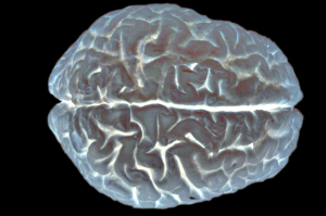 cerveau